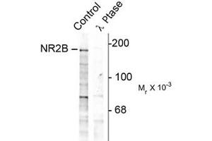 Image no. 1 for anti-Glutamate Receptor, Ionotropic, N-Methyl D-Aspartate 2B (GRIN2B) (pTyr1252) antibody (ABIN303962) (GRIN2B 抗体  (pTyr1252))