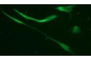 Immunofluorescence (IF) image for anti-Vimentin (VIM) (pSer33) antibody (ABIN1449152) (Vimentin 抗体  (pSer33))