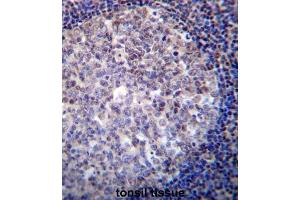 Immunohistochemistry (IHC) image for anti-Recombination Activating Gene 2 (RAG2) antibody (ABIN2996750) (RAG2 抗体)