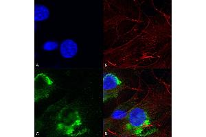 Immunocytochemistry/Immunofluorescence analysis using Mouse Anti-GFAP R416WT Monoclonal Antibody, Clone S206B-9 (ABIN1740978). (GFAP 抗体  (AA 411-422) (PerCP))