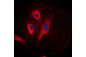 Immunofluorescent analysis of CARD6 staining in Jurkat cells. (CARD6 抗体  (N-Term))