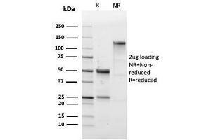 SDS-PAGE (SDS) image for anti-Sialophorin (SPN) antibody (ABIN6940641)