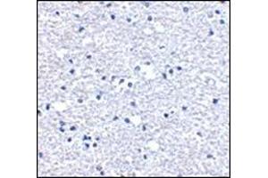 Immunohistochemistry of PD-1 in human brain tissue with this product at 5 μg/ml. (PD-1 抗体  (Center))