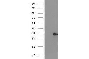 Western Blotting (WB) image for anti-Haloacid Dehalogenase-Like Hydrolase Domain Containing 2 (HDHD2) antibody (ABIN1498627) (HDHD2 抗体)