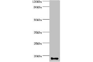 Western blot All lanes: Calmodulin-like protein 5 antibody at 12 μg/mL + A431 whole cell lysate Secondary Goat polyclonal to rabbit IgG at 1/10000 dilution Predicted band size: 16 kDa Observed band size: 16 kDa (CALML5 抗体  (AA 1-146))