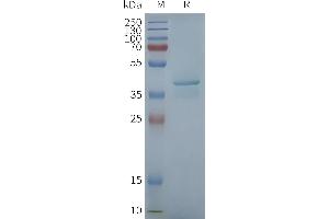 Human ST-Nanodisc, Flag Tag on SDS-PAGE (STING1 蛋白)