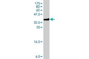 Western Blot detection against Immunogen (34. (S100A6 抗体  (AA 18-90))