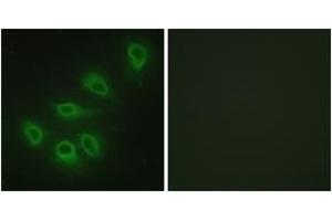 Immunofluorescence analysis of HeLa cells, using eNOS (Ab-1179) Antibody. (ENOS 抗体  (AA 1145-1194))