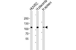 Western blot analysis of lysates from HUVEC cell line , huamn placenta and spleen tissue lysate(from left to right), using GP1BA(Glycocalicin) Antibody (Center) (ABIN6242723 and ABIN6577497). (CD42b 抗体  (AA 344-378))