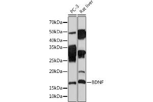 Western blot analysis of extracts of various cell lines, using BDNF Rabbit mAb (ABIN7265916) at 1:1000 dilution. (BDNF 抗体)