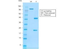 SDS-PAGE (SDS) image for anti-Membrane-Spanning 4-Domains, Subfamily A, Member 1 (MS4A1) antibody (ABIN6941111)