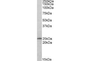 Western Blotting (WB) image for anti-RAN, Member RAS Oncogene Family (RAN) antibody (ABIN5876166) (RAN 抗体)