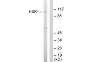 Western Blotting (WB) image for anti-Hexokinase 1 (HK1) (AA 31-80) antibody (ABIN2889414) (Hexokinase 1 抗体  (AA 31-80))