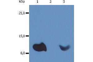 Western Blotting Western Blotting analysis (non-reducing conditions) of whole cell lysate of various cell lines using anti-human β2-microglobulin (B2M-01). (beta-2 Microglobulin 抗体  (Biotin))