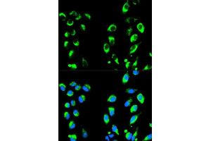 Immunofluorescence analysis of HeLa cell using NFKBIA antibody. (NFKBIA 抗体  (AA 1-317))