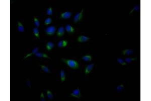 Immunofluorescence staining of Hela Cells with ABIN7127338 at 1:50, counter-stained with DAPI. (Recombinant APP 抗体)