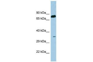 SDS antibody used at 1 ug/ml to detect target protein. (serine Dehydratase 抗体  (N-Term))