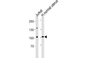 Western Blotting (WB) image for anti-Telomerase Reverse Transcriptase (TERT) antibody (ABIN2997736) (TERT 抗体)