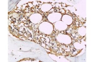 Immunohistochemistry (Paraffin-embedded Sections) (IHC (p)) image for anti-Tumor Necrosis Factor (Ligand) Superfamily, Member 11 (TNFSF11) (AA 221-300) antibody (ABIN668556)