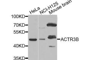 Western blot analysis of extracts of various cell lines, using ACTR3B antibody (ABIN5975654) at 1/1000 dilution. (ACTR3B 抗体)