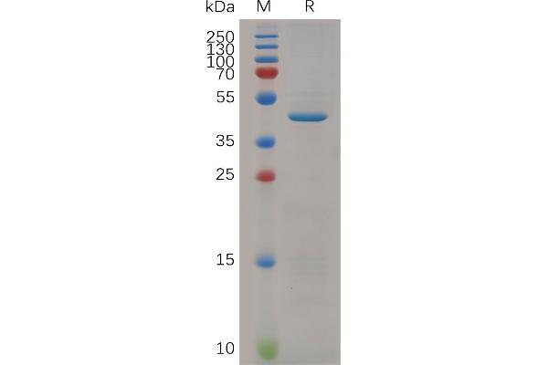 RNASE4 Protein (AA 30-148) (Fc Tag)