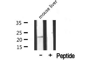 Western blot analysis of extracts from mouse liver, using MRPL20 antibody. (MRPL20 抗体  (C-Term))
