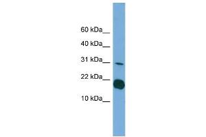 WB Suggested Anti-IL1F5 Antibody Titration: 0. (FIL1d 抗体  (Middle Region))