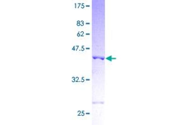 PDCD5 Protein (AA 1-125) (GST tag)