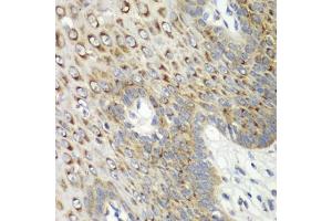 Immunohistochemistry of paraffin-embedded human esophagus using CDK1 antibody (ABIN6134274, ABIN6138303, ABIN6138304 and ABIN6219543) at dilution of 1:100 (40x lens). (CDK1 抗体  (AA 208-258))