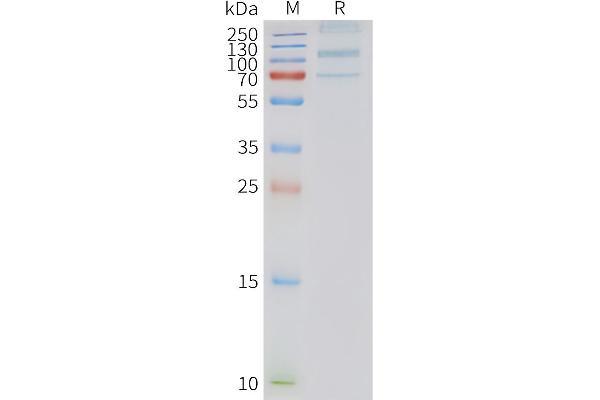 G Protein-Coupled Receptor 133 Protein (GPR133)