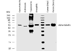 Western blotting analysis of human alpha-tubulin using rat monoclonal antibody YOL1/34 on lysates of Caenorhabditis elegans, Arabidopsis thaliana, Trypanosoma brucei, Drosophila melanogaster, human HeLa cell line, and porcine brain, all under reducing conditions. (alpha Tubulin 抗体)