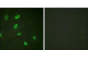 Immunofluorescence analysis of HeLa cells, using Histone H2B (Acetyl-Lys5) Antibody. (Histone H2B 抗体  (acLys5))