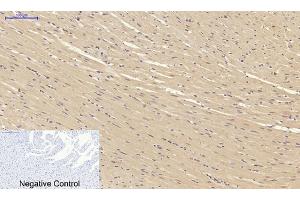 Immunohistochemical analysis of paraffin-embedded rat heart tissue. (SMAD2 抗体)