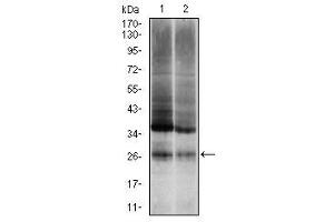 Image no. 2 for anti-Ubiquitin B (UBB) antibody (ABIN1501611) (Ubiquitin B 抗体)