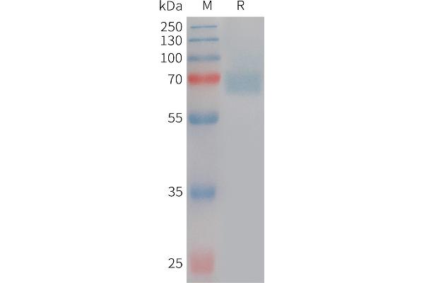 Acetylcholinesterase Protein (AChE) (AA 32-614) (His tag)