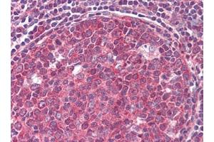 Human Tonsil (formalin-fixed, paraffin-embedded) stained with CD19followed by biotinylated goat anti-rabbit IgG secondary antibody, alkaline phosphatase-streptavidin and chromogen. (CD19 抗体  (C-Term))