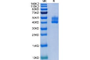 SDS-PAGE (SDS) image for CD3D & CD3E (AA 23-126) protein (Fc Tag) (ABIN7274146)