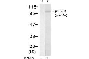 Image no. 1 for anti-Ribosomal Protein S6 Kinase, 90kDa, Polypeptide 1 (RPS6KA1) (pSer352) antibody (ABIN319222) (RPS6KA1 抗体  (pSer352))