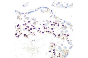 Immunohistochemistry of paraffin-embedded rat testis using HP1 alpha/CBX5Rabbit mAb (ABIN1678748, ABIN3018030, ABIN3018031 and ABIN7101571) at dilution of 1:100 (40x lens). (CBX5 抗体)