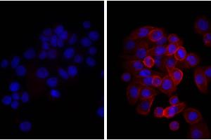 Human pancreatic carcinoma cell line MIA PaCa-2 was stained with Mouse Anti-Human CD44-UNLB, and DAPI. (驴 anti-小鼠 IgG (Heavy & Light Chain) Antibody)