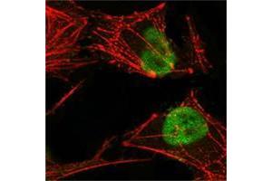 Confocal immunofluorescence analysis of Hela cells using MSH2 antibody (green), showing nuclear localization. (MSH2 抗体)