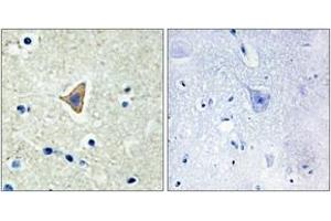 Immunohistochemistry analysis of paraffin-embedded human brain tissue, using CDH20 Antibody. (Cadherin 20 抗体  (AA 111-160))