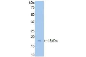 Detection of Recombinant CST3, Rat using Polyclonal Antibody to Cystatin C (Cys-C) (CST3 抗体  (AA 21-140))