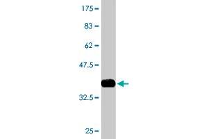 Western Blot detection against Immunogen (36. (EPM2A 抗体  (AA 101-199))