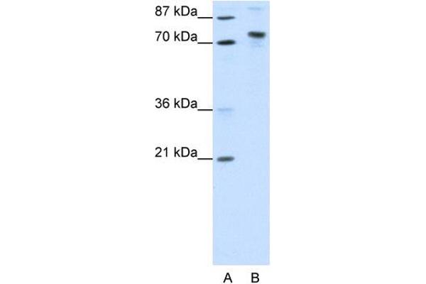 TOX4 抗体  (N-Term)