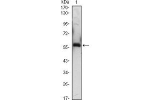 Western blot analysis using A1BG mouse mAb against A1BG-hIgGFc transfected HEK293 (3)cell lysate. (A1BG 抗体)