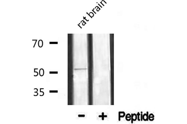 alpha 1 Adrenergic Receptor 抗体  (Internal Region)