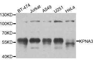 Western blot analysis of extracts of various cell lines, using KPNA3 antibody. (KPNA3 抗体)