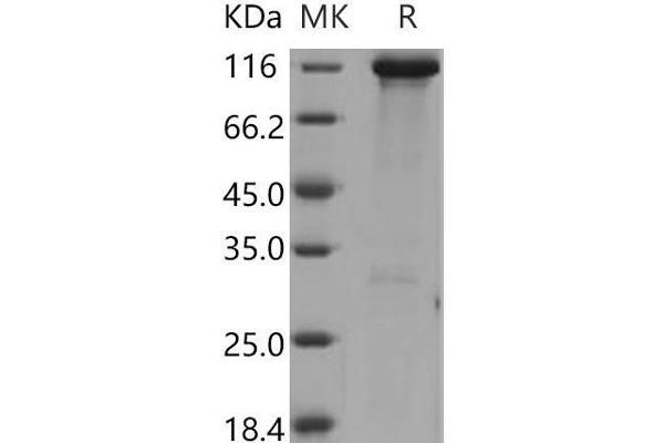 HK3 Protein (GST tag,His tag)