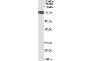 FOXP2 抗体  (C-Term)